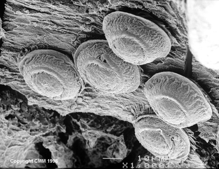 M.I.I. Encephaloendoprothetische Denk-Coprozessoren